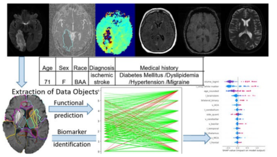 Composite brain imaging workflow showing MRI scans and a stroke case with patient details (age, sex, diagnosis, medical history), followed by extraction of brain regions for functional prediction and biomarker identification, and a feature analysis plot with SHAP values.